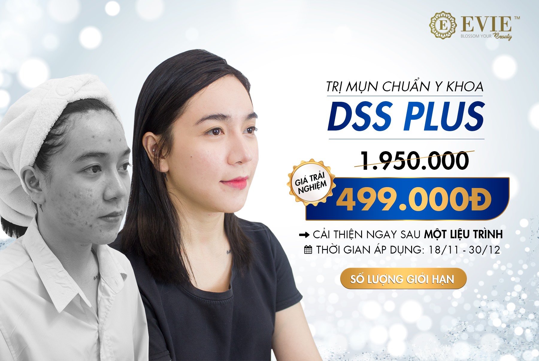 Loạt Spa giảm sâu giá dịch vụ trong tháng 11 này - Ảnh 3. Loạt Spa giảm sâu giá dịch vụ trong tháng 11 này - Ảnh 3.