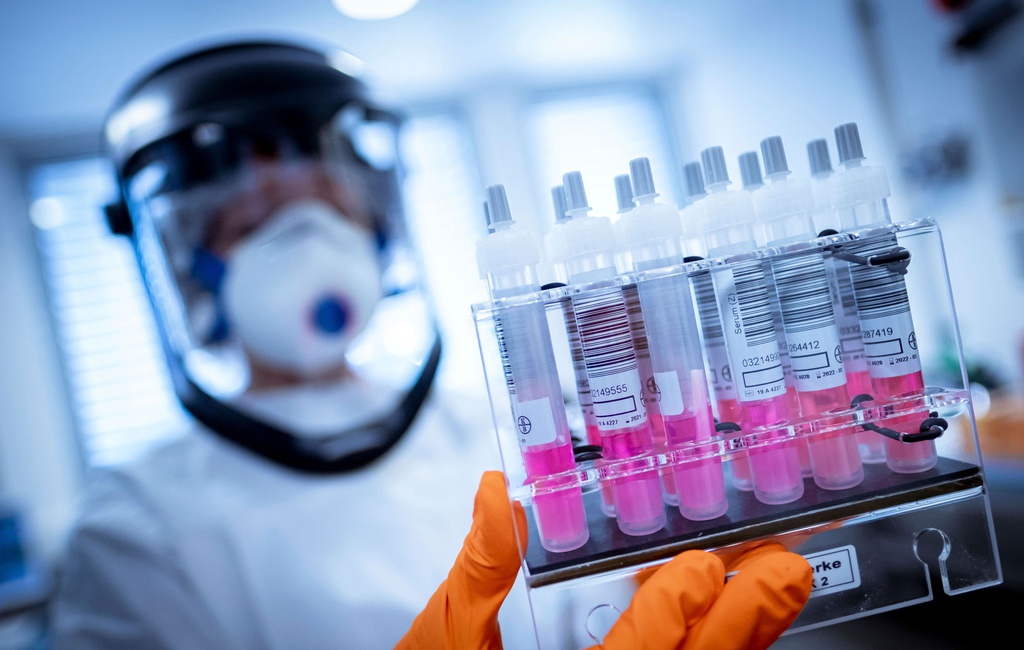 Nếu con người không thay đổi, Covid-19 chưa phải đại dịch tệ nhất - Ảnh 1. Nếu con người không thay đổi, Covid-19 chưa phải đại dịch tệ nhất - Ảnh 1.