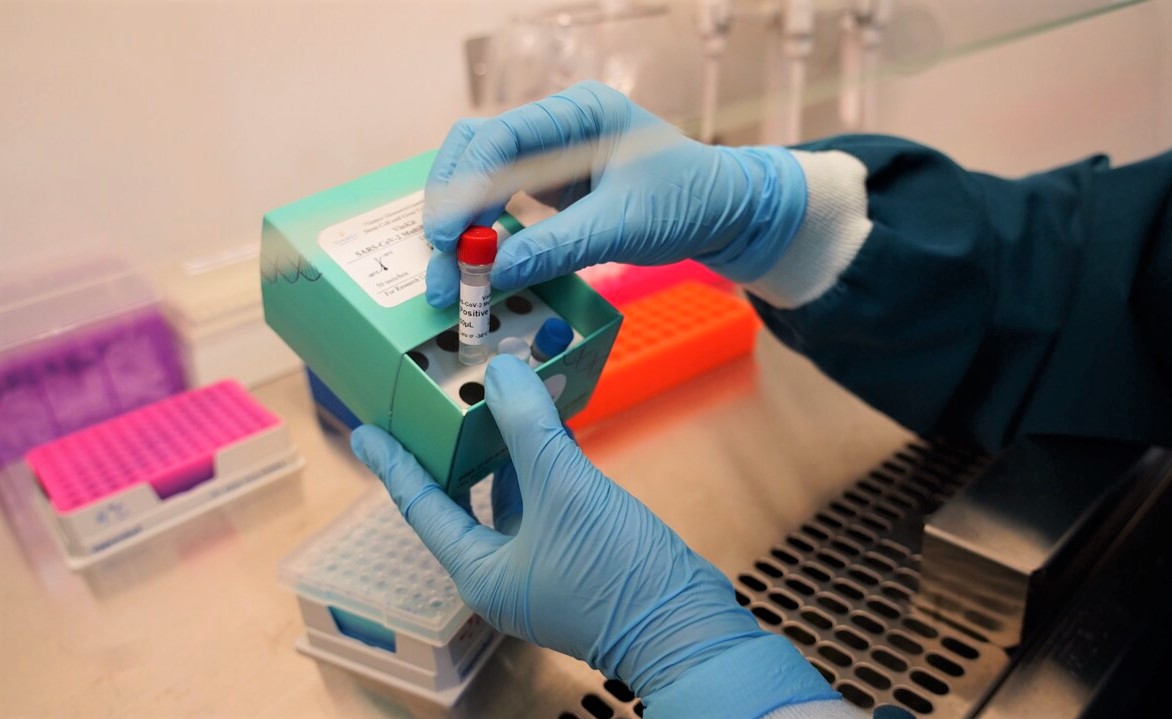 Việt Nam phát triển thành công hai bộ Kit xét nghiệm virus SARS-CoV-2 đạt độ chính xác 100% - Ảnh 1. Việt Nam phát triển thành công hai bộ Kit xét nghiệm virus SARS-CoV-2 đạt độ chính xác 100% - Ảnh 1.