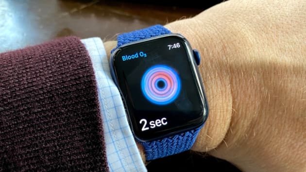 Có nên mua Apple Watch Series 6 vì cảm biến nồng độ oxy trong máu? - Ảnh 6. Có nên mua Apple Watch Series 6 vì cảm biến nồng độ oxy trong máu? - Ảnh 6.
