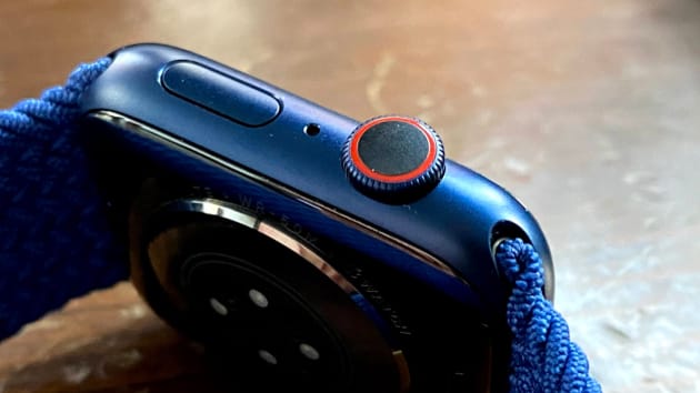 Có nên mua Apple Watch Series 6 vì cảm biến nồng độ oxy trong máu? - Ảnh 2. Có nên mua Apple Watch Series 6 vì cảm biến nồng độ oxy trong máu? - Ảnh 2.