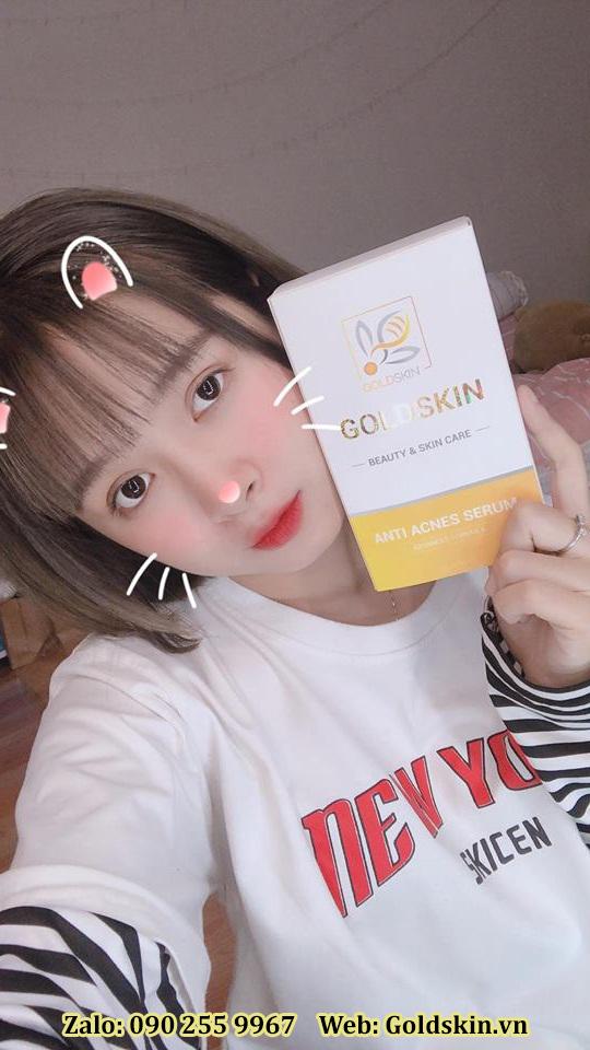 Goldskin – Serum hỗ trợ điều trị mụn trứng cá hiệu quả - Ảnh 4. Goldskin – Serum hỗ trợ điều trị mụn trứng cá hiệu quả - Ảnh 4.