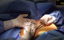Bệnh nhân tử vong sau nâng ngực, bệnh viện khẳng định 'ca phẫu thuật thành công, đúng quy trình'