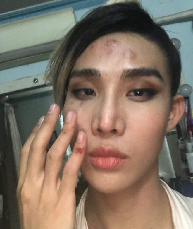 Tài xế Go-Viet tố ngược người mẫu The Face chửi 'hãng ngu, tài xế ngu' - Ảnh 3.