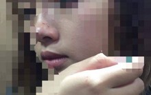 Nữ sinh bị cưỡng hôn trong thang máy muốn được xin lỗi công khai