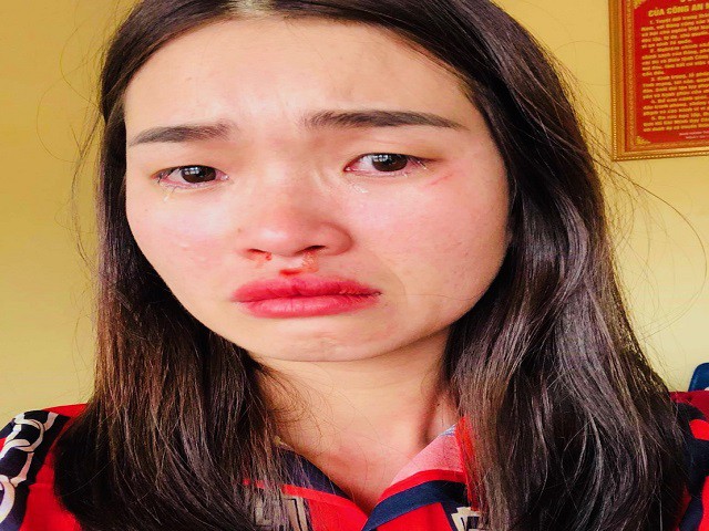 Vụ chủ xe hành hung hành khách ở Hà Tĩnh: Chồng lao vào đấm, vợ lao vào tát - Ảnh 2. Vụ chủ xe hành hung hành khách ở Hà Tĩnh: Chồng lao vào đấm, vợ lao vào tát - Ảnh 2.
