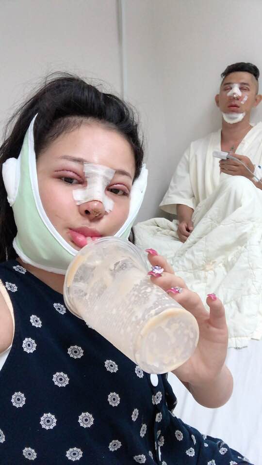 Loạt ảnh công khai ảnh dao kéo của Lương Bằng Quang và bạn gái khiến ai xem cũng rợn người - Ảnh 4.