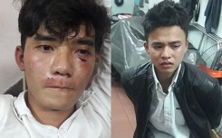 Khởi tố hai thanh niên ném đá Công an Đà Nẵng đang làm nhiệm vụ