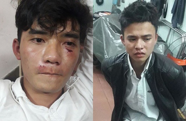 Khởi tố hai thanh niên ném đá Công an Đà Nẵng đang làm nhiệm vụ - Ảnh 1. Khởi tố hai thanh niên ném đá Công an Đà Nẵng đang làm nhiệm vụ - Ảnh 1.