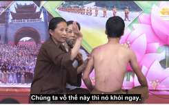 Bác sĩ lên tiếng về phương pháp 'vỗ dầu hỏa' chữa đau lưng của cô Yến chùa Ba Vàng