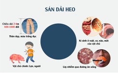 Ngoài sán lợn, đây là những loại giun sán đáng sợ kí sinh trong cơ thể người
