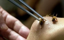 Ong vò vẽ tấn công, một người chết nhiều người khác nguy kịch
