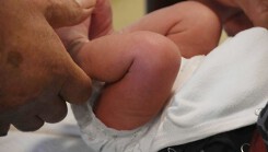 Bố mẹ tự tay cắt bao qui đầu tại nhà, con trai 5 tháng tử vong