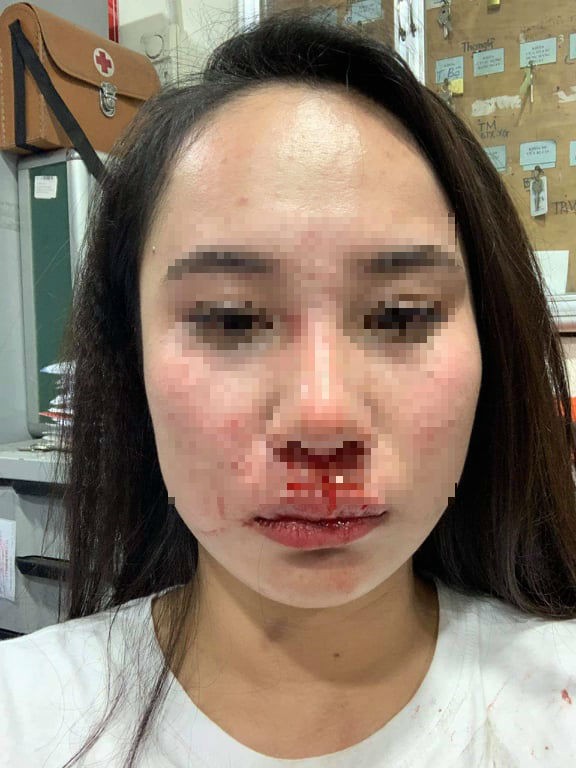 Xác minh nghi án đánh ghen ở Vincom Hà Nội - Ảnh 2. Xác minh nghi án đánh ghen ở Vincom Hà Nội - Ảnh 2.