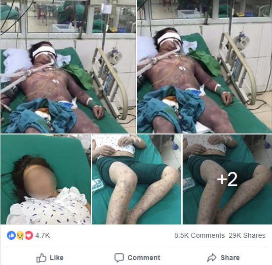 Sự thật đằng sau hình ảnh hai người bị nghi bị nhiễm vi rút tả lợn - Ảnh 7. Sự thật đằng sau hình ảnh hai người bị nghi bị nhiễm vi rút tả lợn - Ảnh 7.