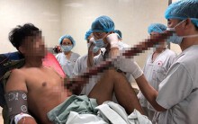 Bác sĩ thức trắng đêm cứu nam thanh niên bị thanh sắt dài 2m đâm thấu ngực