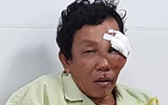 6 nạn nhân bị thương do Lexus biển 6666 tông đã qua cơn nguy kịch