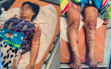 Vụ thai phụ bị tra tấn như thời trung cổ: Nạn nhân còn yếu nên chưa khai thác được gì