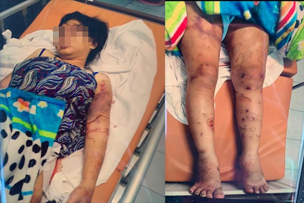 Vụ thai phụ bị tra tấn như thời trung cổ: Nạn nhân còn yếu nên chưa khai thác được gì - Ảnh 1.