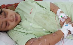 Thai phụ bị tra tấn đến sẩy thai đang bị sang chấn tâm lí