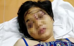 Anh trai cô gái 18 tuổi bị tra tấn đến sẩy thai khai lí do không cứu em