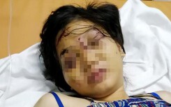 Người phụ nữ vứt xác đứa con sinh non của thai phụ bị tra tấn dã man có phạm tội hình sự?