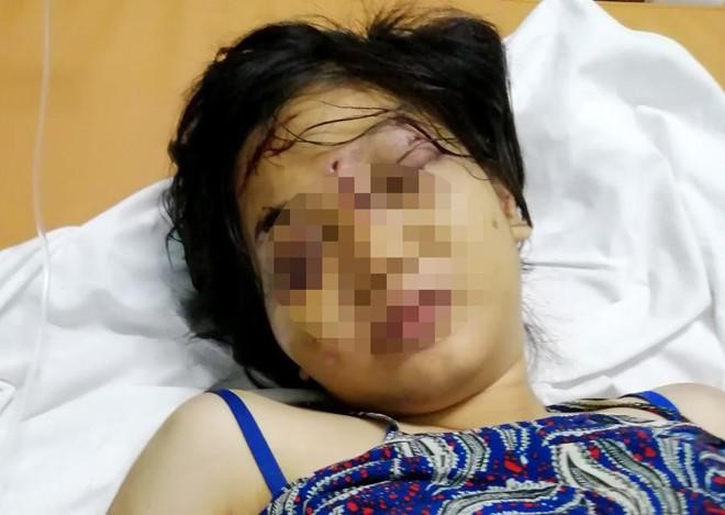 Anh trai cô gái 18 tuổi bị tra tấn đến sẩy thai khai lí do không cứu em - Ảnh 1.