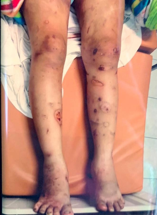 Anh trai cô gái 18 tuổi bị tra tấn đến sẩy thai khai lí do không cứu em - Ảnh 2.