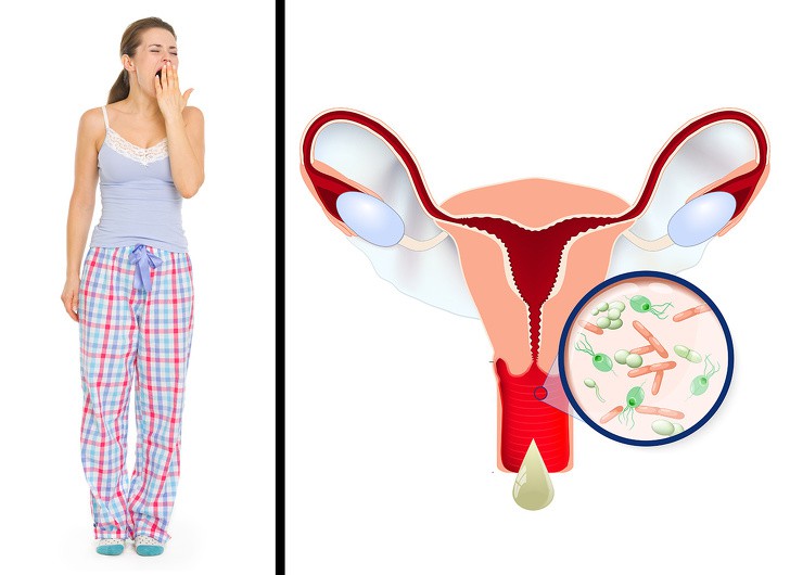 Đây là kiểu thời trang phang sức khỏe mang tai họa đến cho cơ thể bạn - Ảnh 8. Đây là kiểu thời trang phang sức khỏe mang tai họa đến cho cơ thể bạn - Ảnh 8.