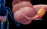 Đau ruột thừa là căn bệnh cấp tính, có thể đe dọa tính mạng