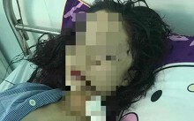 Vụ cô gái bị rạch mặt khâu 60 mũi ở Bắc Ninh: Kẻ thủ ác là bạn của nạn nhân?