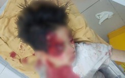 Hà Nội: Nghi vấn xe ô tô gây tai nạn kéo lê cháu bé dưới lòng đường rồi bỏ chạy