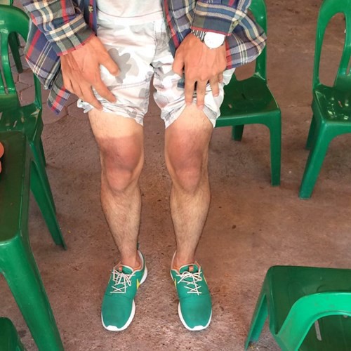 Muốn biết nắng nóng ở Sài Gòn gay gắt thế nào, cứ nhìn những hình xăm cháy nắng dưới đây là rõ - Ảnh 5. Muốn biết nắng nóng ở Sài Gòn gay gắt thế nào, cứ nhìn những hình xăm cháy nắng dưới đây là rõ - Ảnh 5.