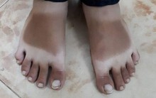 Muốn biết nắng nóng ở Sài Gòn gay gắt thế nào, cứ nhìn những 'hình xăm' cháy nắng dưới đây là rõ
