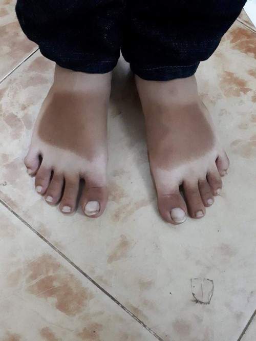 Muốn biết nắng nóng ở Sài Gòn gay gắt thế nào, cứ nhìn những hình xăm cháy nắng dưới đây là rõ - Ảnh 6. Muốn biết nắng nóng ở Sài Gòn gay gắt thế nào, cứ nhìn những hình xăm cháy nắng dưới đây là rõ - Ảnh 6.