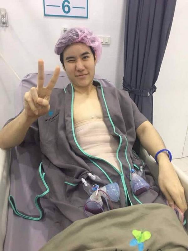 Trào lưu phẫu thuật tạc cơ bụng giá 4000 USD: Con đường ngắn nhất để có 6 múi? - Ảnh 7. Trào lưu phẫu thuật tạc cơ bụng giá 4000 USD: Con đường ngắn nhất để có 6 múi? - Ảnh 7.
