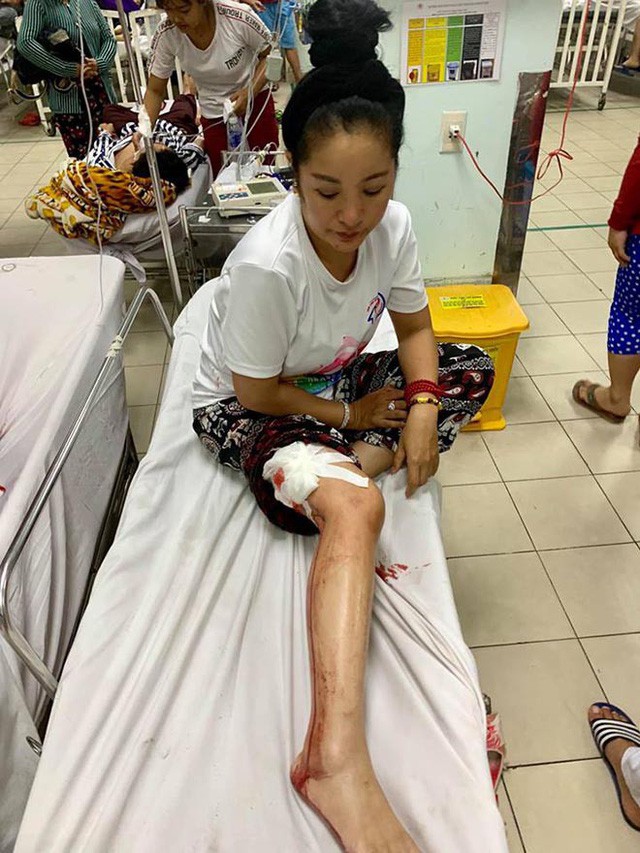 Danh hài Thúy Nga gặp tai nạn, đang cấp cứu tại bệnh viện - Ảnh 2. Danh hài Thúy Nga gặp tai nạn, đang cấp cứu tại bệnh viện - Ảnh 2.