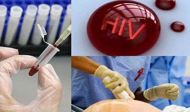 10 người phơi nhiễm HIV ở Sài Gòn: Phơi nhiễm HIV là gì? - Ảnh 1. 10 người phơi nhiễm HIV ở Sài Gòn: Phơi nhiễm HIV là gì? - Ảnh 1.