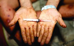 10 người phơi nhiễm HIV ở Sài Gòn: Nhiễm HIV cơ thể con người bị tàn phá đến chết