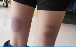 Đạt điểm kém, học sinh bị cô giáo đánh đến 840 cái
