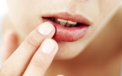 Dùng hết sức nặn mụn trứng cá ở cạnh môi, cô gái trẻ hôn mê nhập viện