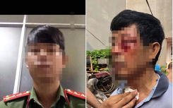 Sự thật thông tin Đại uý công an hành hung người đàn ông chảy máu mặt chỉ vì một cái thùng gỗ
