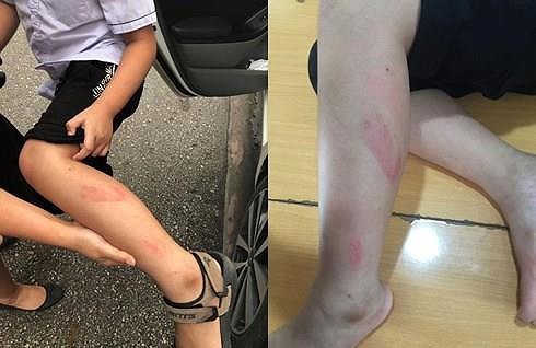 Xem xét buộc thôi việc cô giáo đánh cả chục học sinh - Ảnh 1. Xem xét buộc thôi việc cô giáo đánh cả chục học sinh - Ảnh 1.