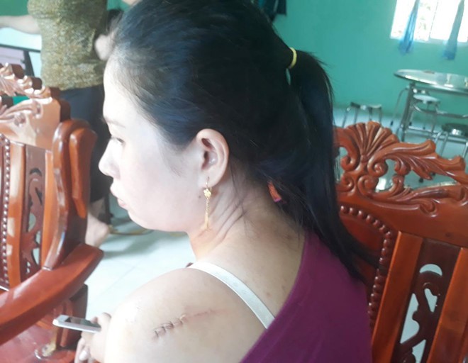 Người chém cô dâu tại tiệc cưới từng dọa xẻo tai chú rể - Ảnh 2. Người chém cô dâu tại tiệc cưới từng dọa xẻo tai chú rể - Ảnh 2.
