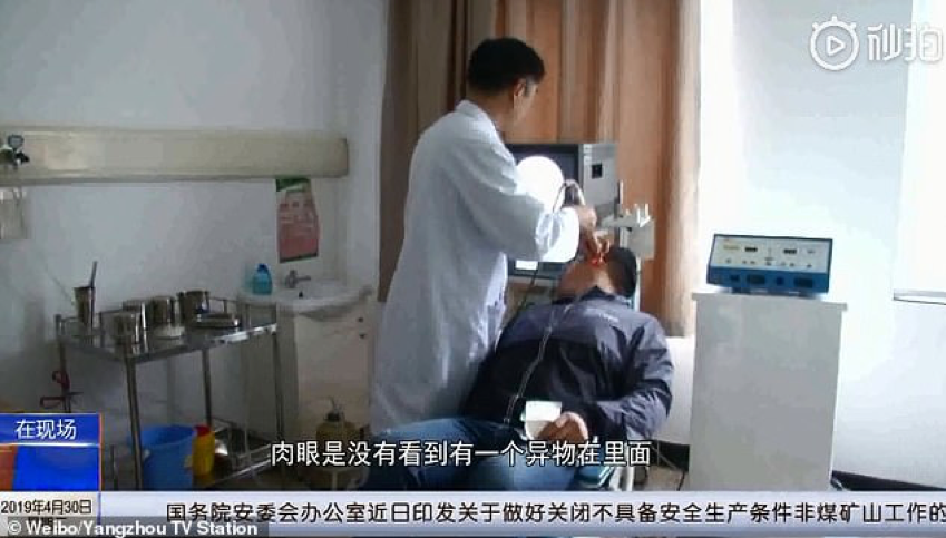 Ngứa không chịu nổi, người đàn ông tá hỏa phát hiện nhện giăng tơ trong tai mình - Ảnh 1.