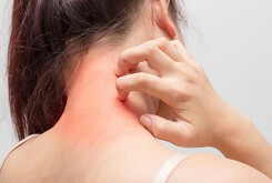Biến đổi khí hậu có thể làm cho bệnh dị ứng theo mùa tồi tệ hơn