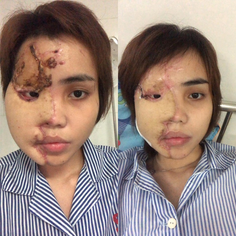 Giám đốc Công an Đà Nẵng nói Thiếu úy tạt a xít vợ sắp cưới là man rợ - Ảnh 1. Giám đốc Công an Đà Nẵng nói Thiếu úy tạt a xít vợ sắp cưới là man rợ - Ảnh 1.