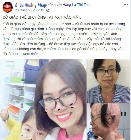 Cộng đồng mạng chung tay mang lại phép màu cho cô giáo trẻ bị chồng tạt axit - Ảnh 1.