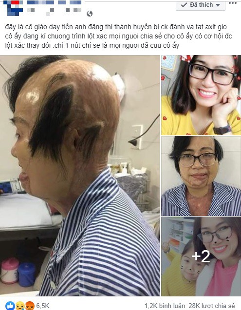 Cộng đồng mạng chung tay mang lại phép màu cho cô giáo trẻ bị chồng tạt axit - Ảnh 3.