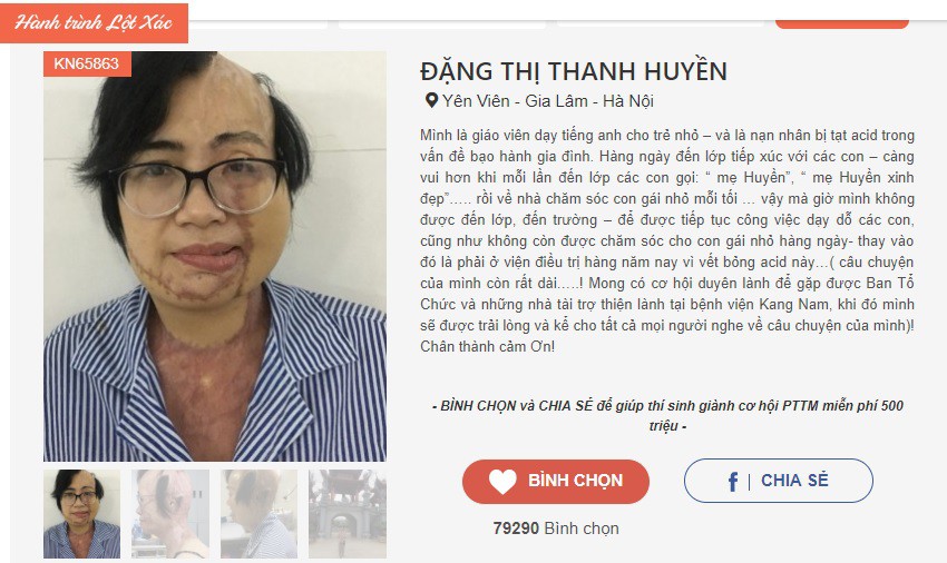 Cộng đồng mạng chung tay mang lại phép màu cho cô giáo trẻ bị chồng tạt axit - Ảnh 2.